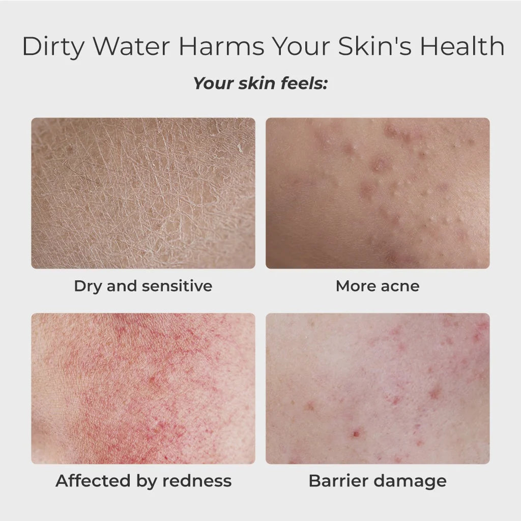 Skincare Face Washer LITE BFC3